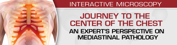 uscap journey to the center of the chest an experts perspective on mediastinal pathology 2021 cme videos 63a1611a28ca0 | Medical Books & CME Courses