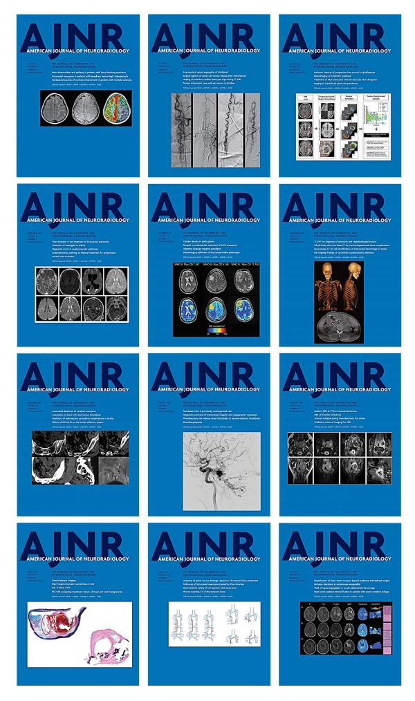 american journal of neuroradiology 2022 full archives true pdf 63ee10f2f1ac6 | Medical Books & CME Courses