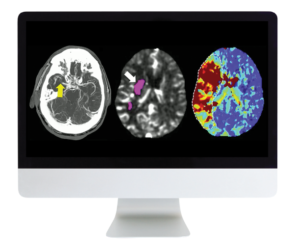 arrs code stroke what every radiologist should know 2022 cme videos 63ec6752d7ad0 | Medical Books & CME Courses