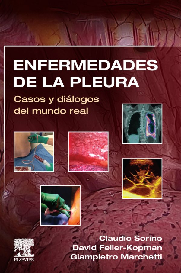 enfermedades de la pleura casos y dialogos del mundo real true pdf 63ee094969133 | Medical Books & CME Courses