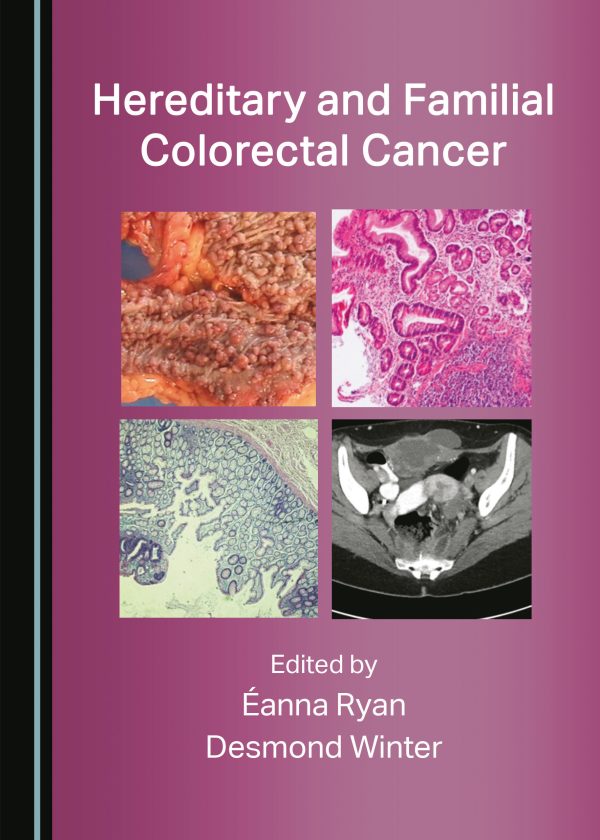 hereditary and familial colorectal cancer original pdf from publisher 63ed2d19aaabd | Medical Books & CME Courses