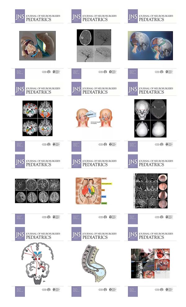 journal of neurosurgery pediatrics 2022 full archives true pdf 63ed6d7680266 | Medical Books & CME Courses