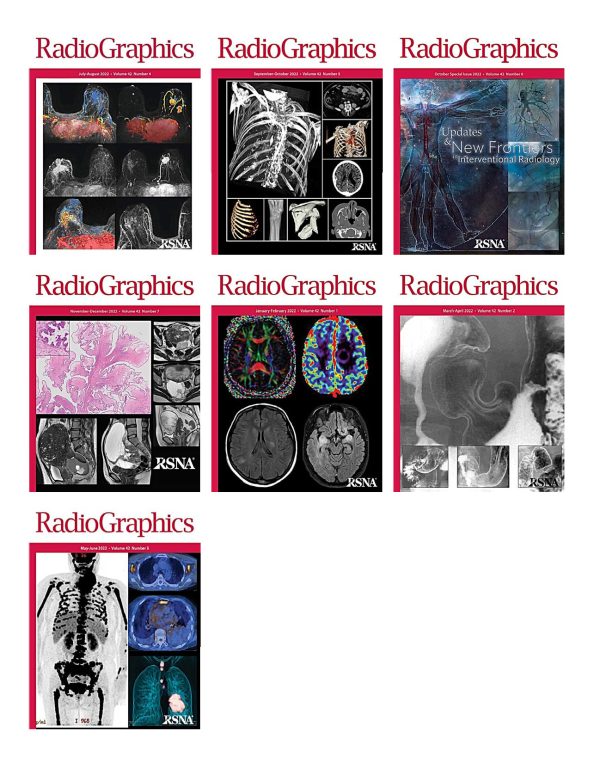 radiographics 2022 full archives true pdf 63ed63e6ee31a | Medical Books & CME Courses