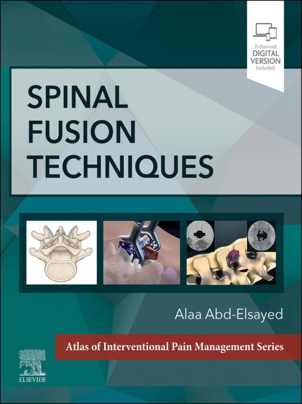 spinal fusion techniques epub 63ee5016bdbd9 | Medical Books & CME Courses