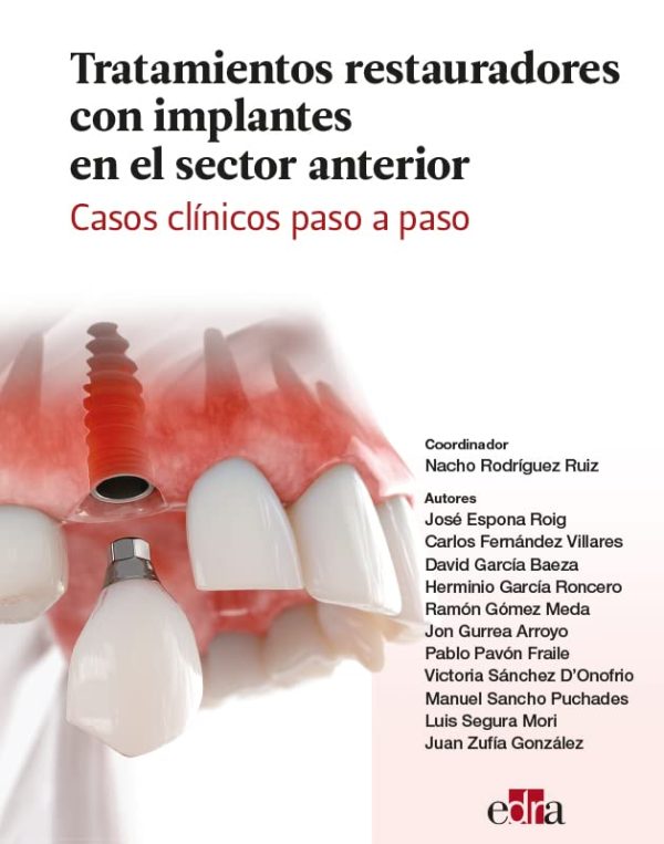 tratamientos restauradores con implantes en el sector anterior casos clinicos paso a paso epub 63ec63b646527 | Medical Books & CME Courses