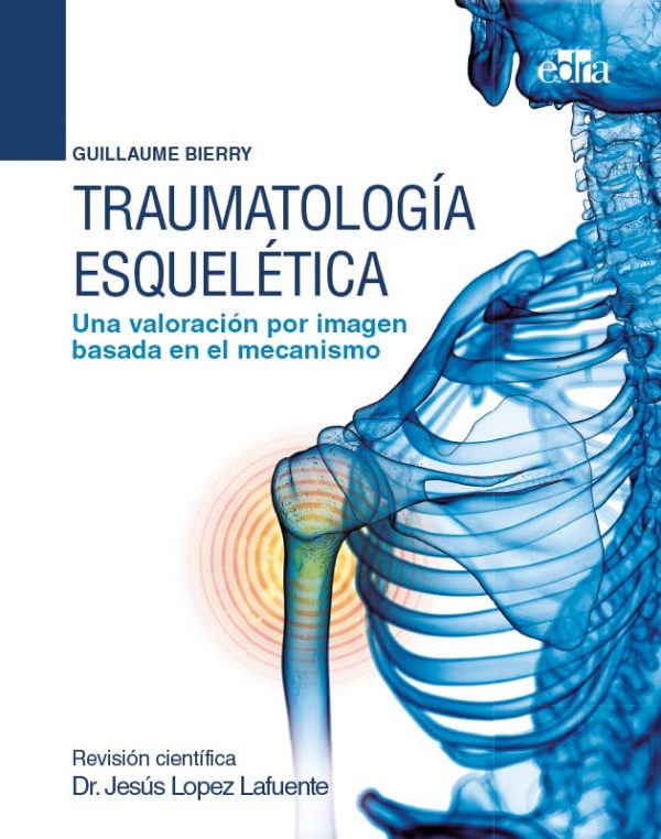 traumatologia esqueletica una valoracion por imagen basada en el mecanismo epub 63ec48cf5de75 | Medical Books & CME Courses