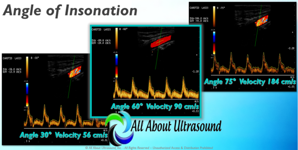 mastering doppler principles and hemodynamics allaboutultrasound complete html 644bc45c4ce61 | Medical Books & CME Courses