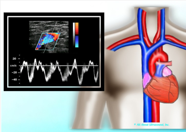 mastering upper extremity duplex allaboutultrasound complete html 644bc471e429a | Medical Books & CME Courses