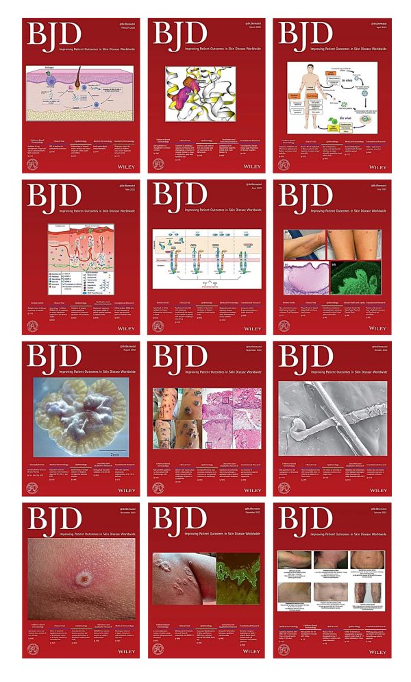 british journal of dermatology 2022 full archives true pdf 6453a950a9c76 | Medical Books & CME Courses