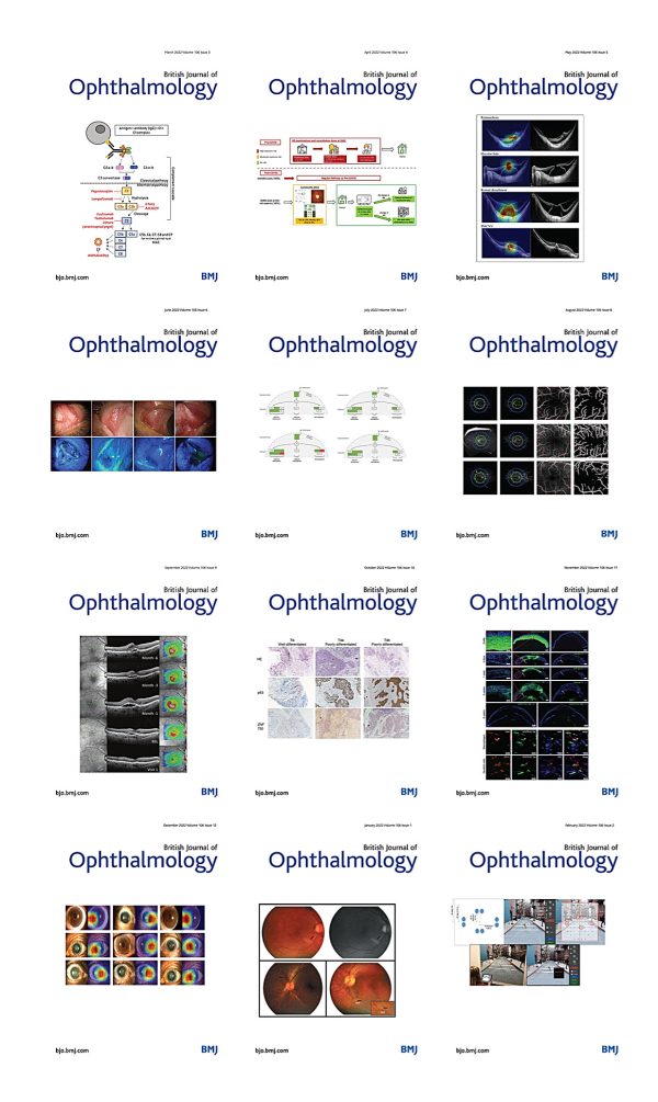 british journal of ophthalmology 2022 full archives true pdf 645b9714aedc1 | Medical Books & CME Courses