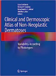 Clinical and Dermoscopic Atlas of Non-Neoplastic Dermatoses: Variability According to Phototypes (Original PDF from Publisher) 1 | Medical Books & CME Courses clinical and dermoscopic atlas of non neoplastic dermatoses variability according to phototypes original pdf from publisher 64a22a51bd434 | Medical Books & CME Courses