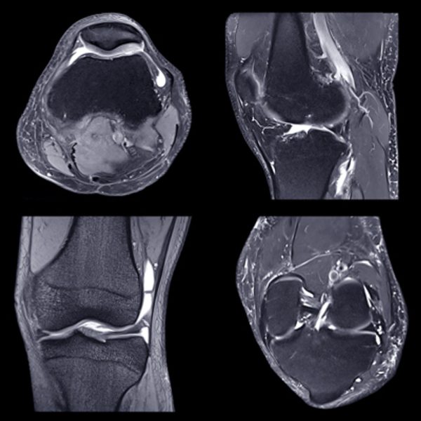 nyu langone advanced imaging of the musculoskeletal system up your game 2023 cme videos 64aaaf74140c3 | Medical Books & CME Courses