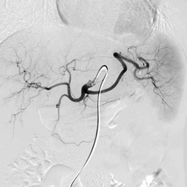 nyu langone vascular and interventional radiology review and update 2023 cme videos 64aaaf7f9cae7 | Medical Books & CME Courses