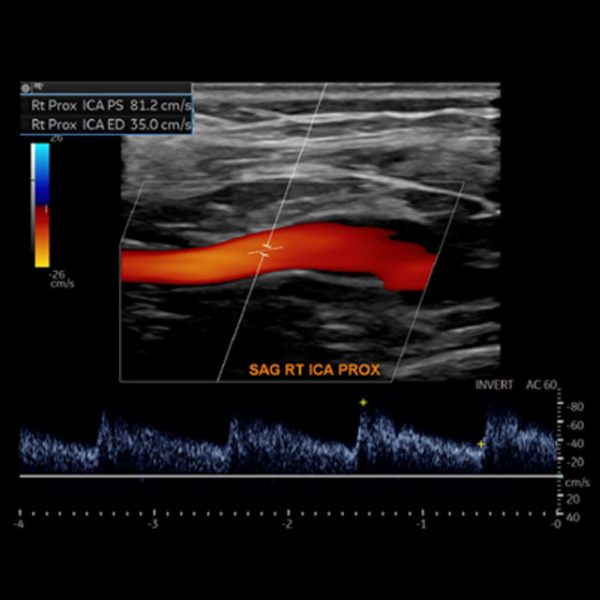 society for vascular medicine comprehensive review of vascular ultrasound interpretation and registry preparation 2023 cme videos 64aaaf89eb02d | Medical Books & CME Courses