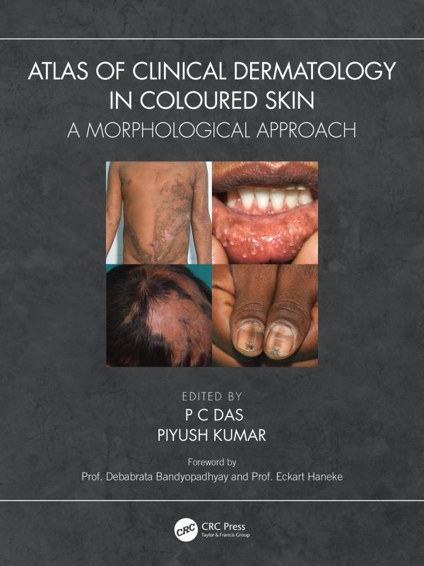 atlas of clinical dermatology in coloured skin epub 64d0ea8b34cba | Medical Books & CME Courses