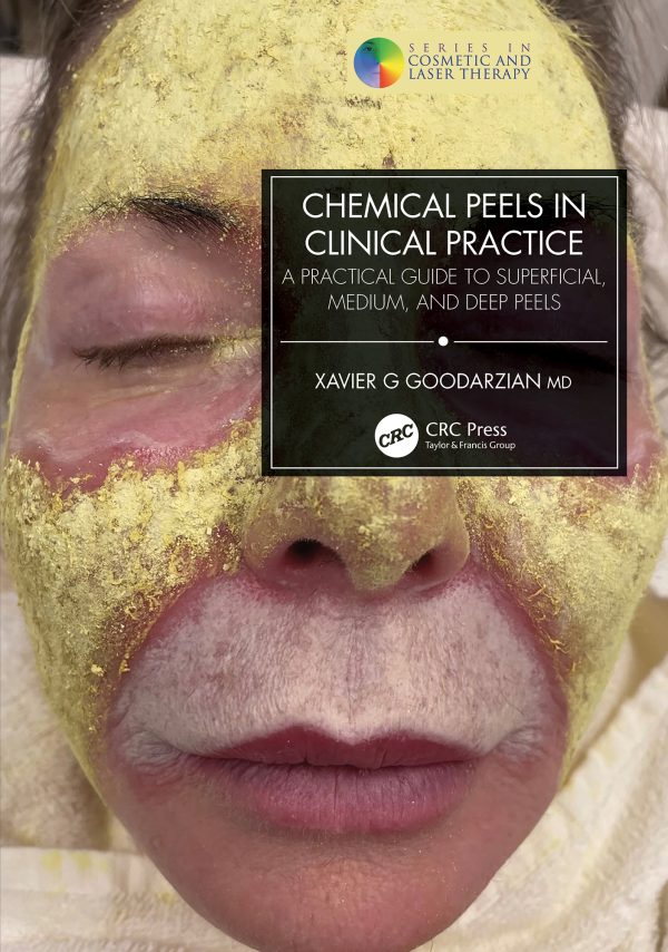 chemical peels in clinical practice original pdf from publisher 64e8a51fa4aec | Medical Books & CME Courses