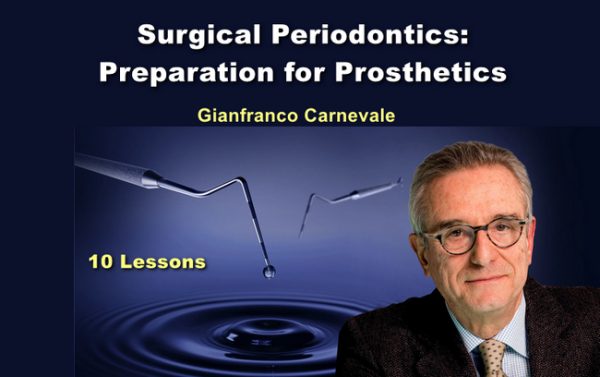 ohi s surgical periodontics preparation for prosthetics videos 64dcc71b1a87b | Medical Books & CME Courses