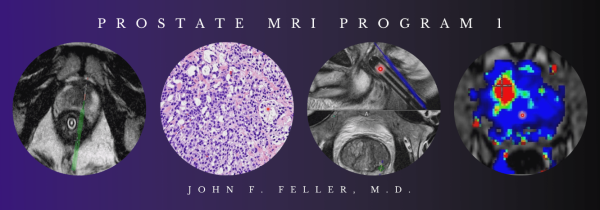 2021 prostate mri program 1 john f feller m d videos 650e2e50114aa | Medical Books & CME Courses