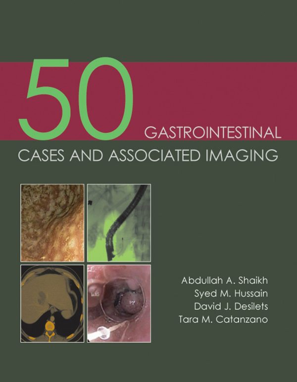 50 gastrointestinal cases and associated imaging original pdf from publisher 64f4816c77e76 | Medical Books & CME Courses