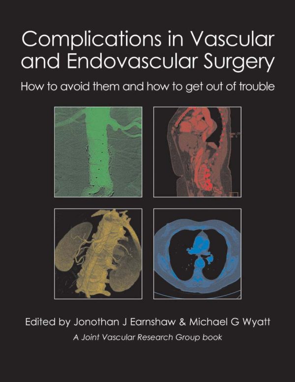 complications in vascular and endovascular surgery how to avoid them and how to get out of trouble epub 64f9c80ebb274 | Medical Books & CME Courses