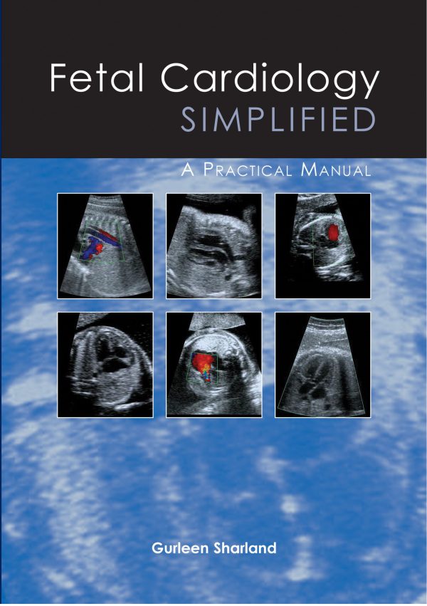 fetal cardiology simplified epub 64f481834269c | Medical Books & CME Courses