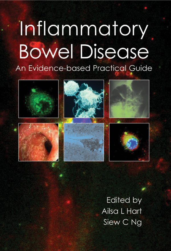 inflammatory bowel disease epub 64f9c745397b3 | Medical Books & CME Courses