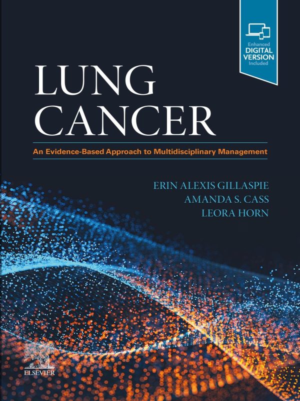 lung cancer an evidence based approach to multidisciplinary management epub 650997ee62634 | Medical Books & CME Courses