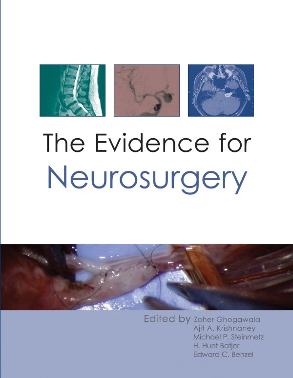 the evidence for neurosurgery epub 64f9c81920a53 | Medical Books & CME Courses