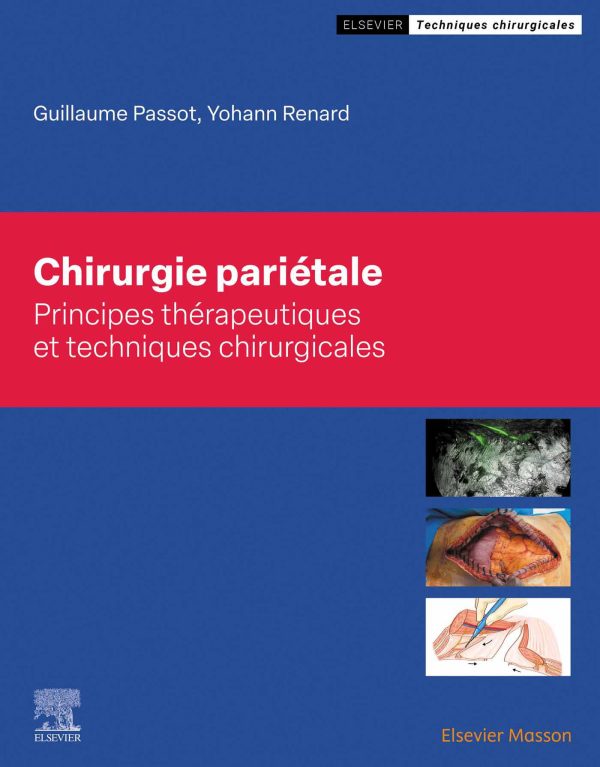 chirurgie parietale original pdf from publisher 6521584a3e1f5 | Medical Books & CME Courses