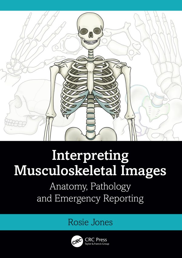 interpreting musculoskeletal images epub 652153fc36a18 | Medical Books & CME Courses